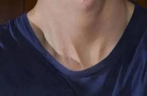 Professional Apparel Bacon-Neckline Repair by Hand